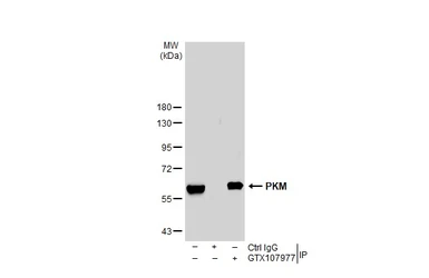 Anti-PKM antibody used in Immunoprecipitation (IP). GTX107977