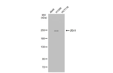 Anti-ZO-1 antibody [N2C1], Internal used in Western Blot (WB). GTX108627