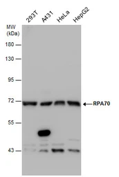 Anti-RPA70 antibody [C1C3] used in Western Blot (WB). GTX108749