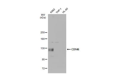 Anti-CD146 antibody [C1C3] used in Western Blot (WB). GTX108777