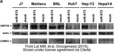 Anti-beta Actin antibody used in Western Blot (WB). GTX109639