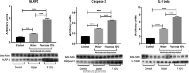 Anti-beta Actin antibody used in Western Blot (WB). GTX109639