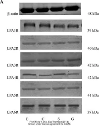 Anti-beta Actin antibody used in Western Blot (WB). GTX109639