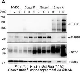 Anti-beta Actin antibody used in Western Blot (WB). GTX109639