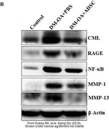 Anti-beta Actin antibody used in Western Blot (WB). GTX109639