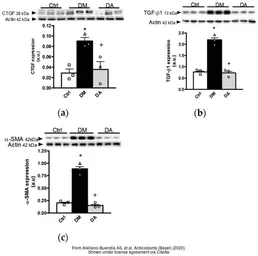 Anti-beta Actin antibody used in Western Blot (WB). GTX109639