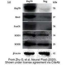 Anti-beta Actin antibody used in Western Blot (WB). GTX109639