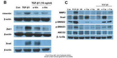 Anti-beta Actin antibody used in Western Blot (WB). GTX109639