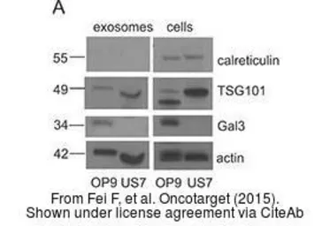 Anti-beta Actin antibody used in Western Blot (WB). GTX109639