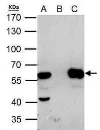 Anti-HDAC2 antibody used in Immunoprecipitation (IP). GTX109642