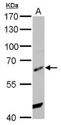 Anti-HDAC2 antibody used in Western Blot (WB). GTX109642