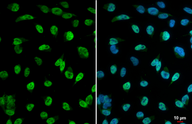 Anti-HDAC2 antibody used in Immunocytochemistry/ Immunofluorescence (ICC/IF). GTX109642