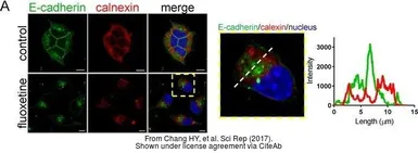 Anti-Calnexin antibody [C3], C-term used in Immunocytochemistry/ Immunofluorescence (ICC/IF). GTX109669