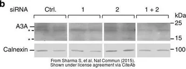 Anti-Calnexin antibody [C3], C-term used in Western Blot (WB). GTX109669