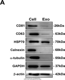 Anti-Calnexin antibody [C3], C-term used in Western Blot (WB). GTX109669