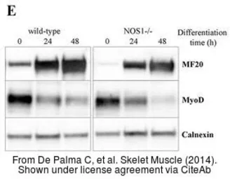 Anti-Calnexin antibody [C3], C-term used in Western Blot (WB). GTX109669