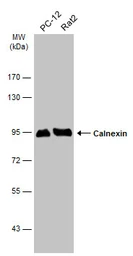 Anti-Calnexin antibody [C3], C-term used in Western Blot (WB). GTX109669