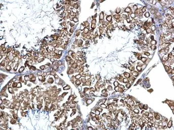 Anti-Calnexin antibody [C3], C-term used in IHC (Paraffin sections) (IHC-P). GTX109669