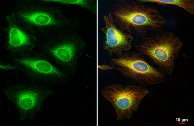 Anti-Calnexin antibody [C3], C-term used in Immunocytochemistry/ Immunofluorescence (ICC/IF). GTX109669