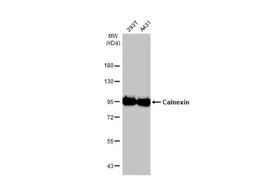 Anti-Calnexin antibody [C3], C-term used in Western Blot (WB). GTX109669