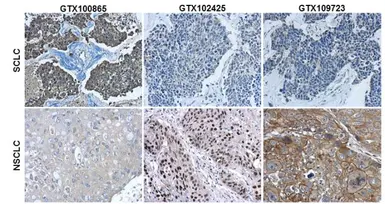 Anti-Cytokeratin 7 antibody [N1C2] used in IHC (Paraffin sections) (IHC-P). GTX109723