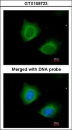 Anti-Cytokeratin 7 antibody [N1C2] used in Immunocytochemistry/ Immunofluorescence (ICC/IF). GTX109723
