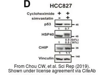 Anti-Vinculin antibody [N3C1], Internal used in Western Blot (WB). GTX109749