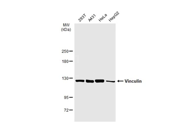 Anti-Vinculin antibody [N3C1], Internal used in Western Blot (WB). GTX109749