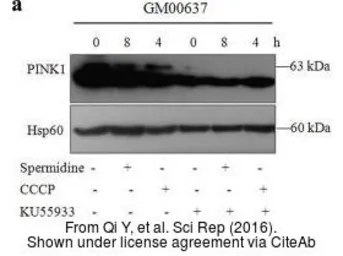 Anti-HSP60 antibody used in Western Blot (WB). GTX110089