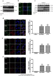Anti-HSP60 antibody used in Western Blot (WB). GTX110089