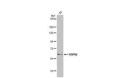 Anti-HSP60 antibody used in Western Blot (WB). GTX110089
