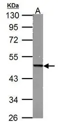 Anti-Fumarate hydratase antibody [N2C2], Internal used in Western Blot (WB). GTX110128