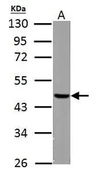 Anti-Fumarate hydratase antibody [N2C2], Internal used in Western Blot (WB). GTX110128