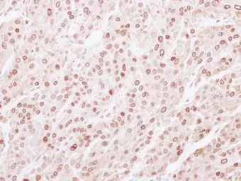 Anti-Lamin B2 antibody used in IHC (Paraffin sections) (IHC-P). GTX110309