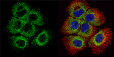 Anti-Bid antibody [N1C3-2] used in Immunocytochemistry/ Immunofluorescence (ICC/IF). GTX110568