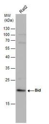 Anti-Bid antibody [N1C3-2] used in Western Blot (WB). GTX110568