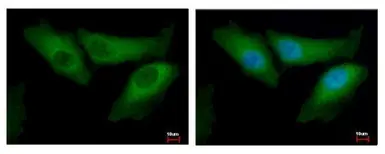 Anti-Bid antibody [N1C3-2] used in Immunocytochemistry/ Immunofluorescence (ICC/IF). GTX110568