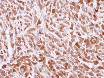 Anti-Bid antibody [N1C3-2] used in IHC (Paraffin sections) (IHC-P). GTX110568