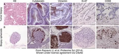 Anti-Cytokeratin 20 antibody [N2C2], Internal used in IHC (Paraffin sections) (IHC-P). GTX110600