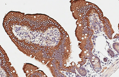 Anti-Cytokeratin 20 antibody [N2C2], Internal used in IHC (Paraffin sections) (IHC-P). GTX110600
