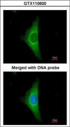 Anti-Cytokeratin 20 antibody [N2C2], Internal used in Immunocytochemistry/ Immunofluorescence (ICC/IF). GTX110600