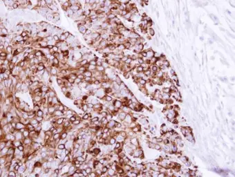 Anti-Cytokeratin 20 antibody [N2C2], Internal used in IHC (Paraffin sections) (IHC-P). GTX110600