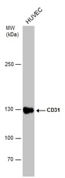 Anti-CD31 antibody [N3C2], Internal used in Western Blot (WB). GTX110602