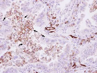 Anti-CD31 antibody [N3C2], Internal used in IHC (Paraffin sections) (IHC-P). GTX110602
