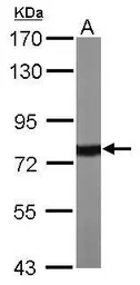 Anti-Hsp70 antibody used in Western Blot (WB). GTX111088