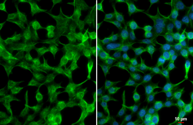 Anti-GSK3 beta antibody [C1C3] used in Immunocytochemistry/ Immunofluorescence (ICC/IF). GTX111192