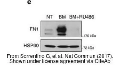 Anti-Fibronectin antibody [N1N2], N-term used in Western Blot (WB). GTX112794