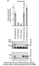 Anti-Fibronectin antibody [N1N2], N-term used in Western Blot (WB). GTX112794