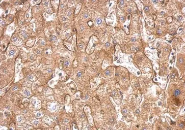 Anti-Fibronectin antibody [N1N2], N-term used in IHC (Paraffin sections) (IHC-P). GTX112794