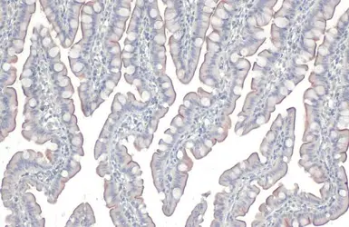 Anti-Fibronectin antibody [N1N2], N-term used in IHC (Paraffin sections) (IHC-P). GTX112794